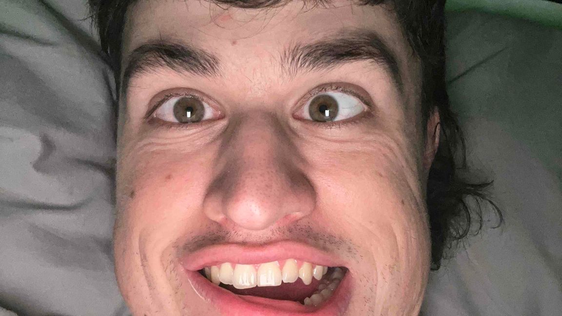 ZXD RHS Supply Drop Rework