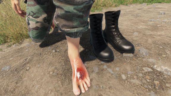 FootPain